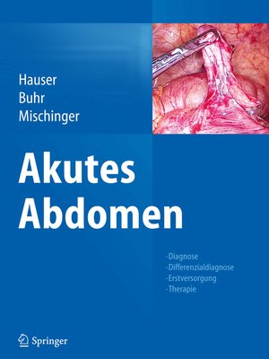 cover image of Akutes Abdomen
